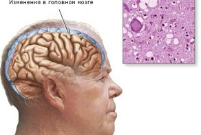 Смертельная девятка: cамые страшные инфекции в мире