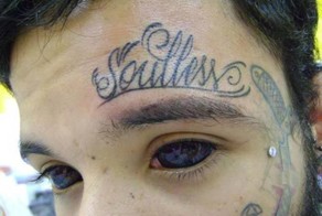 Татуировки на глазном яблоке