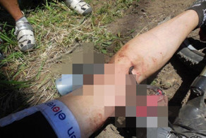 Неудачное падение с велостпеда