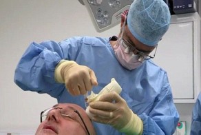 Неудачная операция по пересадке волос