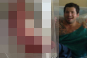 Парню оторвало пальчик