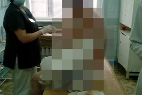Последствия попадания белого фосфора на человека