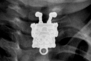 Удивительные рентгеновские снимки