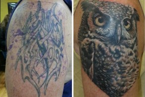25 примеров удачного исправления и перекрытия татуировок