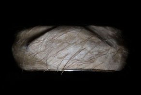 Необычное кольцо из золота и человеческой кожи (20 фото)