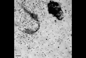 Как лейкоциты атакуют червя-паразита