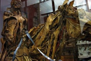 Скульптуры французского хирурга