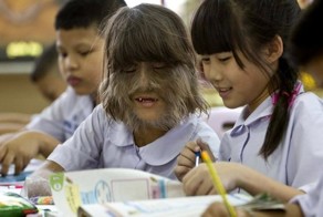 Самые необычные заболевания