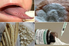 12 самых невероятных лекарств из прошлого