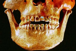 Красота требует жертв!!