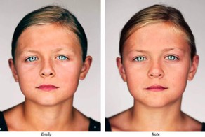 Интересные факты о близнецах