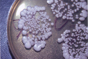 Рак излечим, просто это кому-то не выгодно