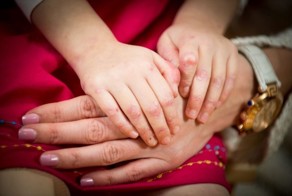 Девочка с рецессивным дистрофическим буллезным эпидермолизом