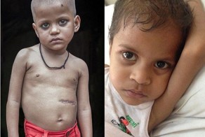 Что появится у вас в желудке, если есть свои волосы