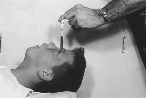 25 самых безумных способов лечения в истории медицины