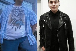 Парень похудел на 122 килограмма и теперь собирает деньги на операцию