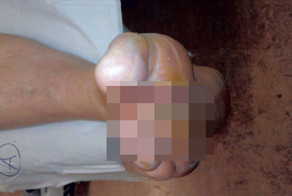 Мужик порезал палец в бассейне