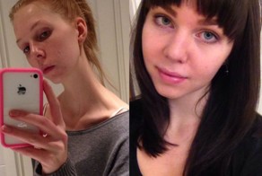 Лучший способ вылечить анорексию - отправиться в спортзал