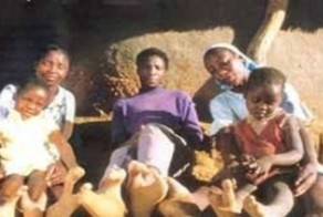 Африканское племя "клешненогих"