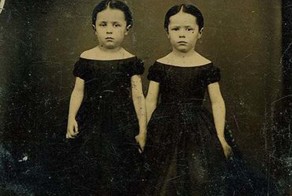 Страшнее, чем пост-мортем: 13 фото близнецов викторианской эпохи