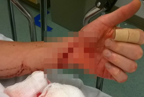 Последствия неосторожной работы на циркулярном станке