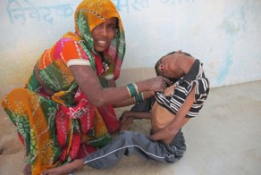 Индийский мальчик с «резиновой» шеей