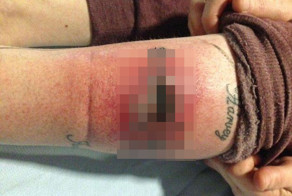 Неудачная татуировка с именем внука на ноге