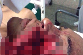 Во время родео бык растоптал наезднику голову