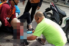 Парень неудачно упал со скутера