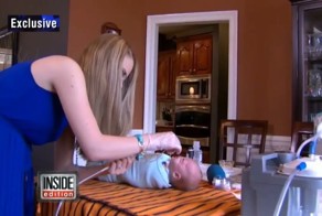 Ребёнок, родившийся без носа, настолько мил, что трогает сердца людей со всего мира