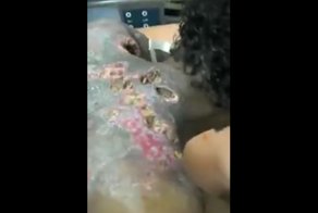 Тело бездомного изъедено червями