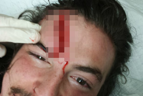 Всегда одевайте шлем