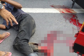 Повредил ступню в ДТП с грузовиком