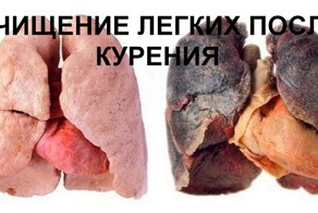 Как очистить легкие после курения: 4 способа, которые выведут токсины 