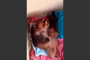 Черви едят голову женщины