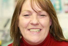 Женщина 10 лет приклеивала зубы суперклеем