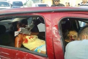 Женщина пытается подправить почти срезанное после аварии лицо