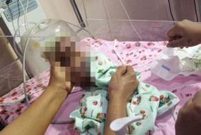 Родители отказались от малышки со страшным заболеванием кожи