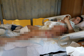 Попал под винт моторной лодки