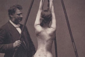 18 одновременно пугающих и завораживающих фотографий медицины прошлого