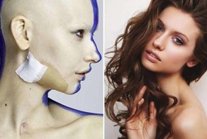 Невероятные фотографии модели, потерявшей челюсть из-за рака