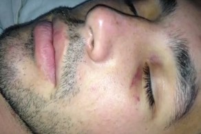 Ушиб мозга, мошонки и выбитые зубы (3 фото+видео)