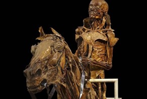 Шокирующе медицинские диковинки, которые хранятся в музеях по всему миру