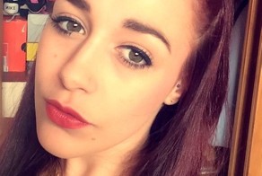 Не в бровь, а в глаз: девушка хотела сделать себе модные брови, а получила страшную аллергическую реакцию