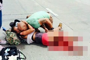 Девушка сильно повредила ногу в ДТП