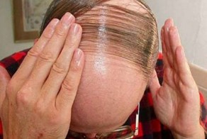 Крутые причёски для лысеющих ребят