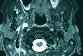 Куда подевалась зубная щетка?