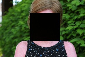 Редкая болезнь делает кожу похожей на обожженную (5 фото)