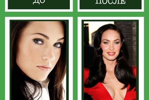 10 знаменитостей до и после пластической хирургии