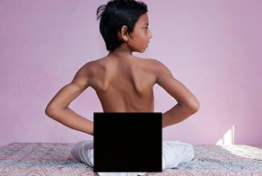 В Индии обожествили мальчика с хвостом (5 фото)